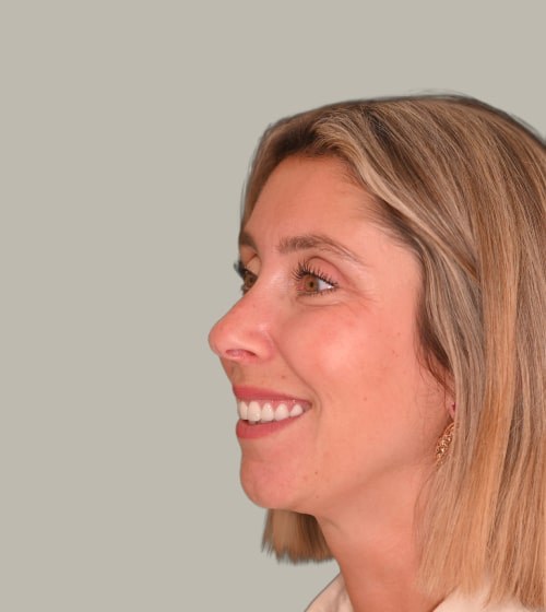 Dental Crowns — Dr Pierre Dentistry Edgecliff