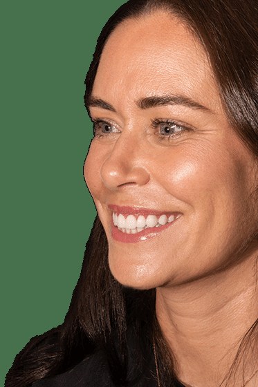 Cosmetic Dentistry — Dr Pierre Dentistry Edgecliff