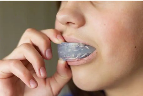 Person fitting an oral appliance — mandibular advancement splint therapy for sleep apnoea